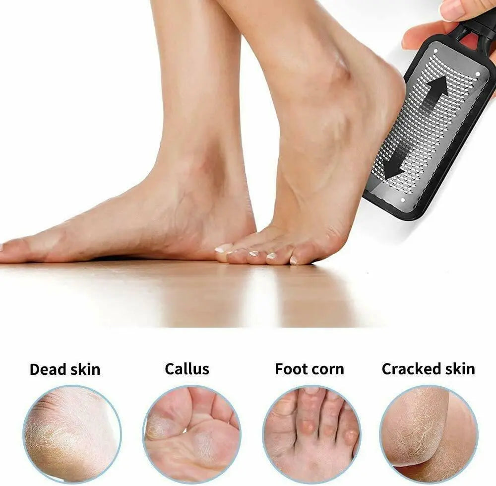 Professional Foot Callus Remover File Rasp Scraper Cracked Pedicure Rough Tool Trendy DigiStore USA