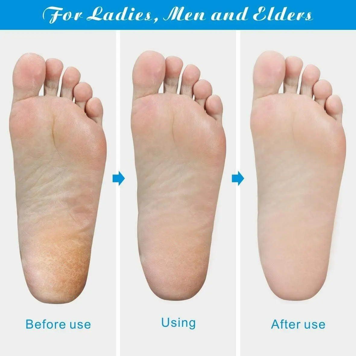 Professional Foot Callus Remover File Rasp Scraper Cracked Pedicure Rough Tool Trendy DigiStore USA