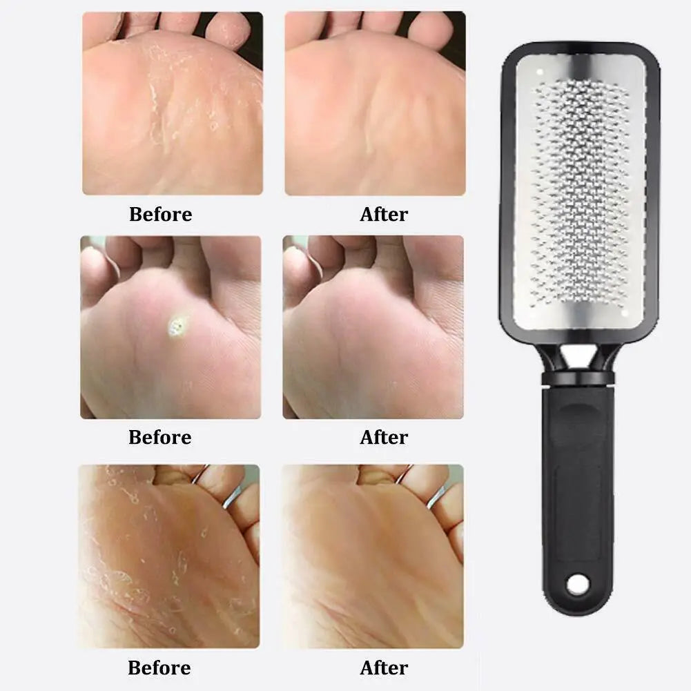 Professional Foot Callus Remover File Rasp Scraper Cracked Pedicure Rough Tool Trendy DigiStore USA
